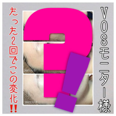 VOSモニター様お写真